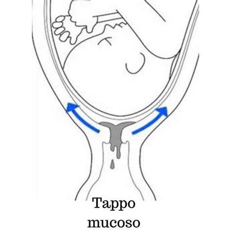 gravidanza precoce cervice tappo di muco