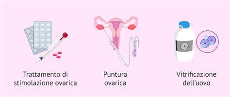 rappresentazione della vagina e degli ovuli