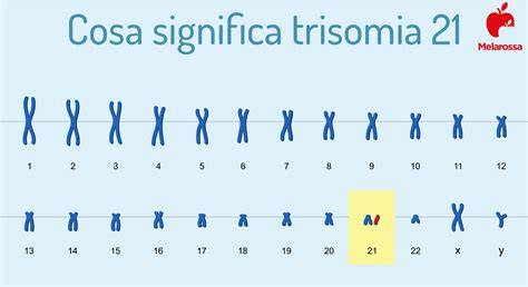 schema della trisomia 21 e sue varianti
