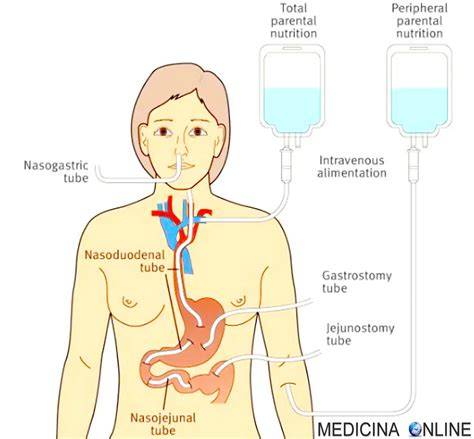 schemi di nutrizione enterale e parenterale