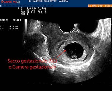 grafico descrittivo camera gestazionale e sacco vitellino