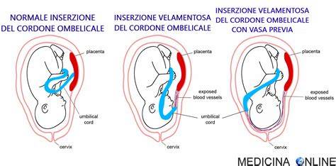 concetti chiave cordone ombelicale