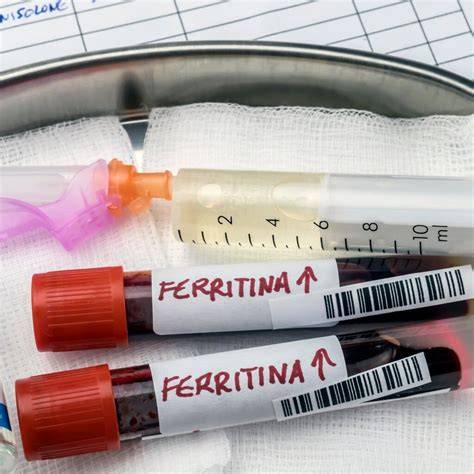 grafico ferritina e ferro nel sangue