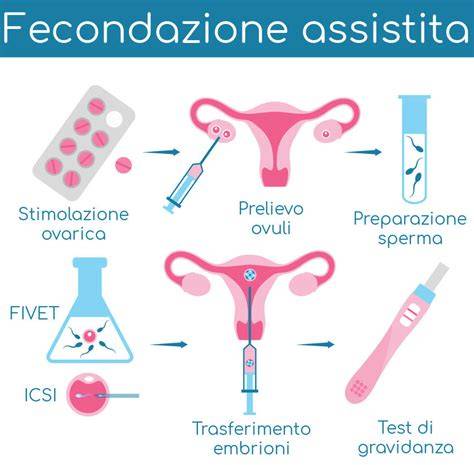 infografica percorso PMA e FIV