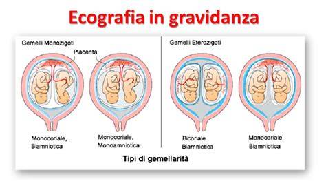 gravidanze singole e gemellari e tobacco